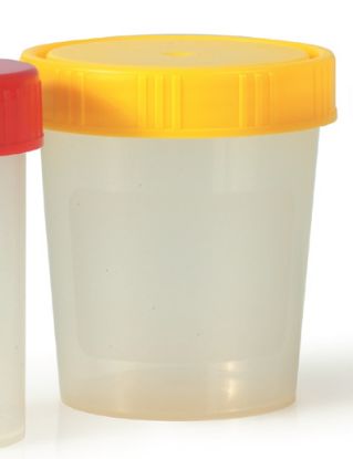 [MPAW1131203/10] Urine Cup Screw On Yellow Cap x 10 Sterile