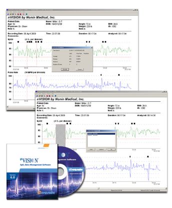 [MPPRN-VISION2500] N-Vision Software (INC Download Cable)