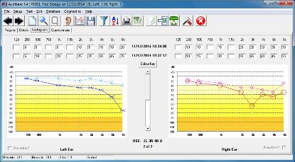 [MPA12AUDIBASE] Audiometer Audiometric Audibase Pc Database